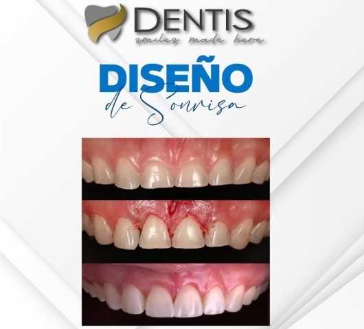 diseño sonrisa